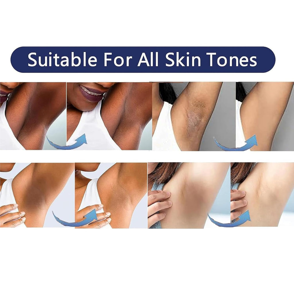 Ultimate Ears Skin Bleaching Cream Skin Lightening for Body Intimate Areas, Private Parts, Underarm, Knees, Elbows, Inner Thigh, Bikini Area, Whitening Cream Dark Spot Remover For Intimate Areas (1FL OZ)